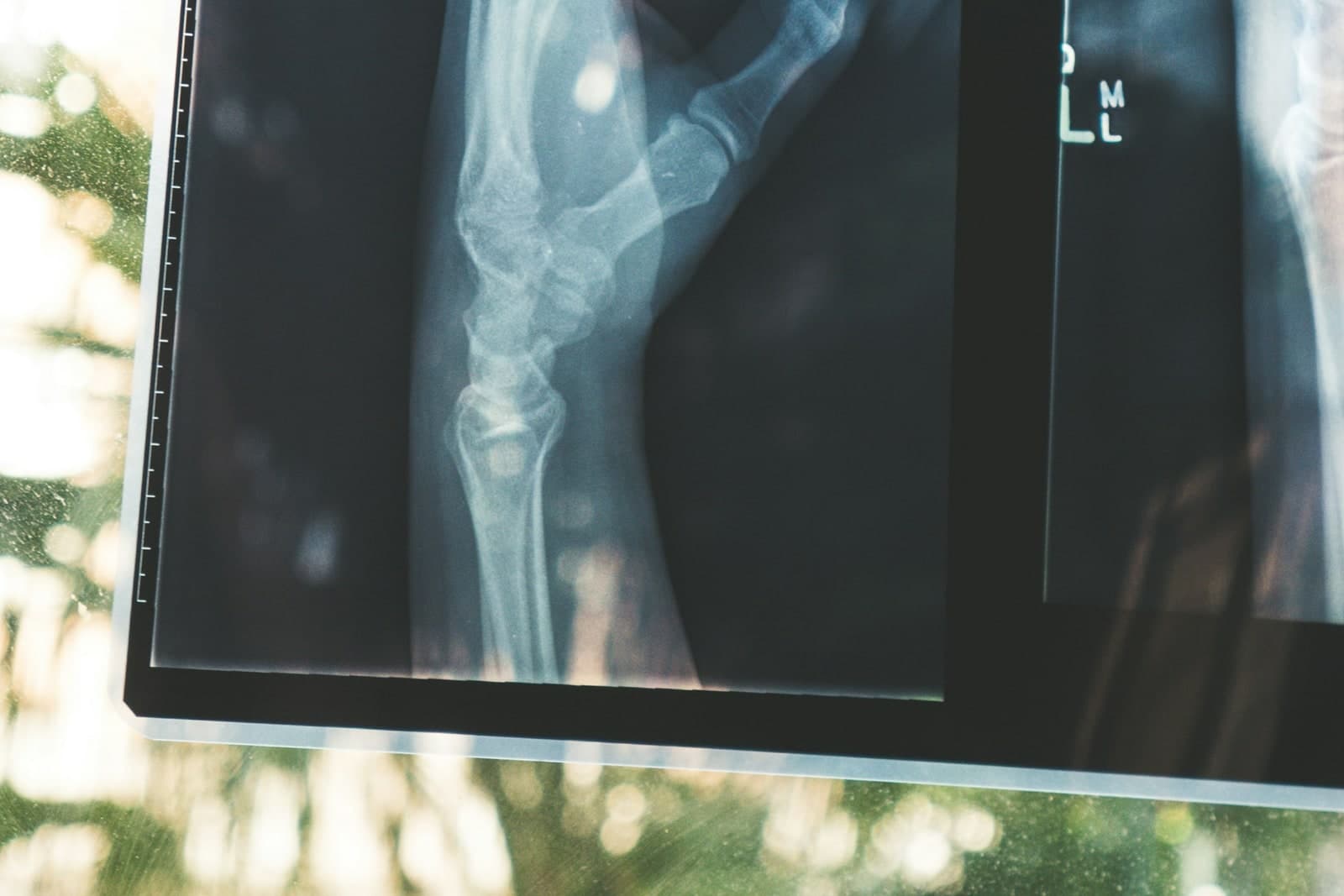 Clinical imaging result held up to light for medical software strategy.